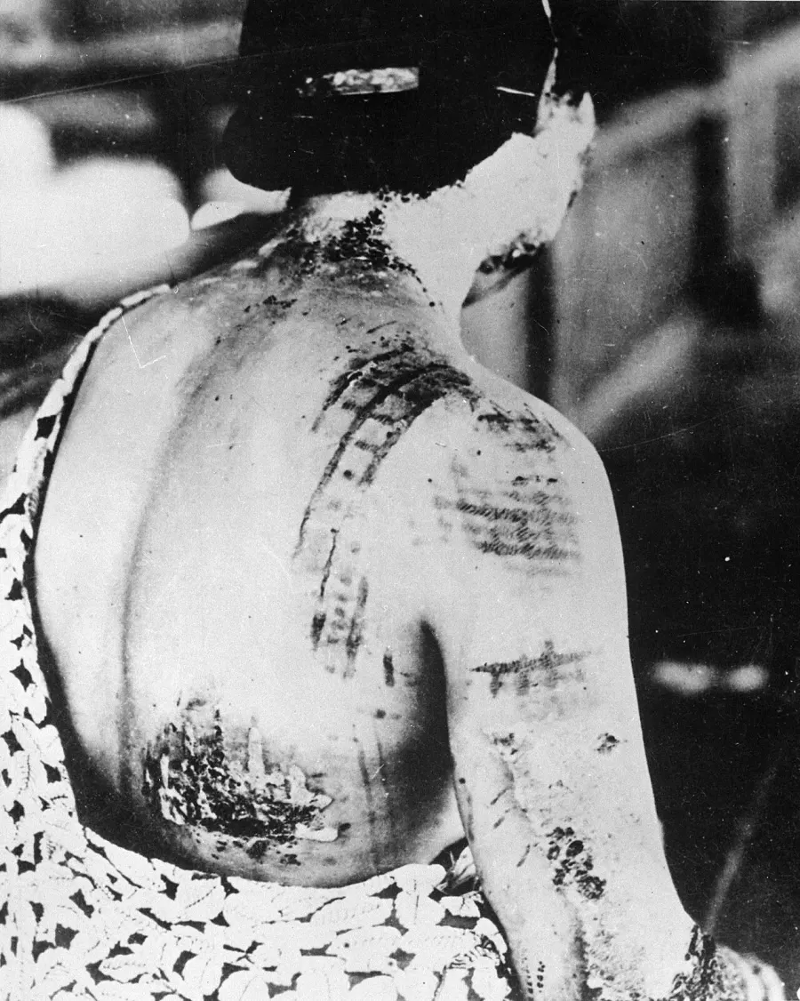 The Hibakusha card