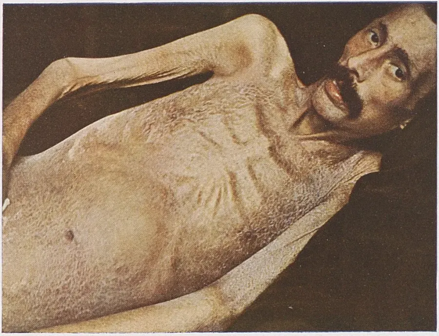 The Cachexia card