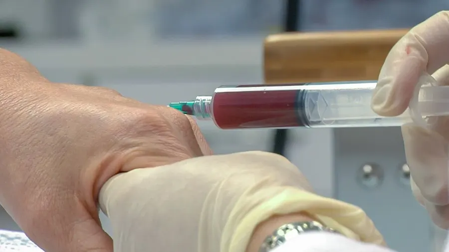 The Platelet-rich plasma card