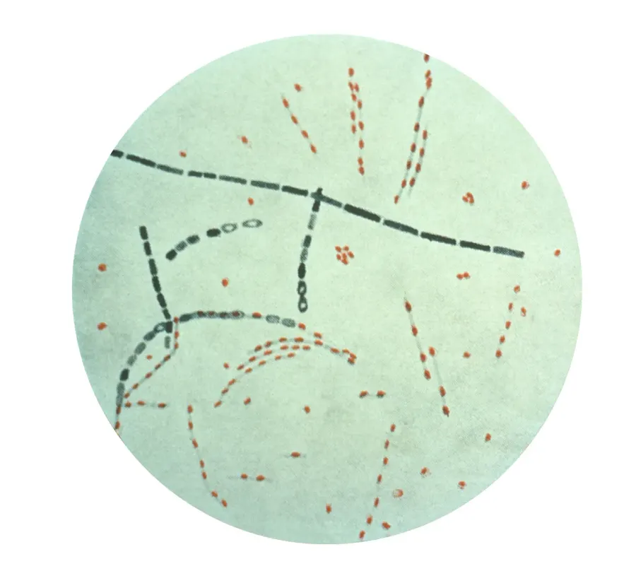 La carte Bacillus anthracis