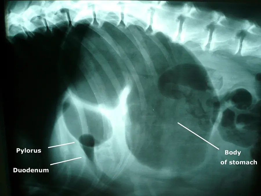 The Gastric dilatation volvulus card