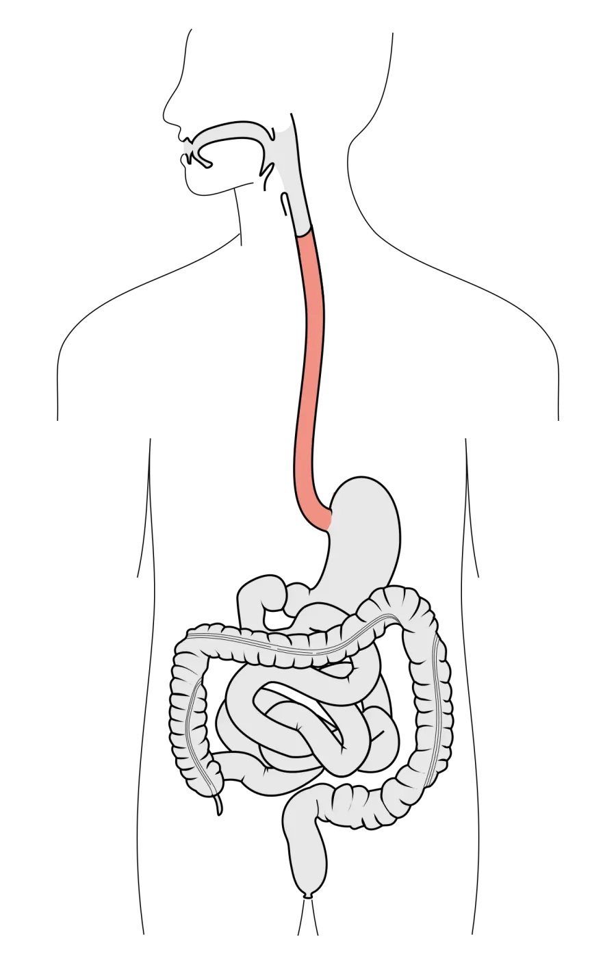 The Dysphagia card