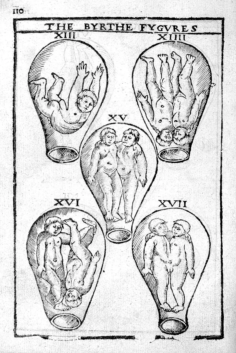 The Teratology card