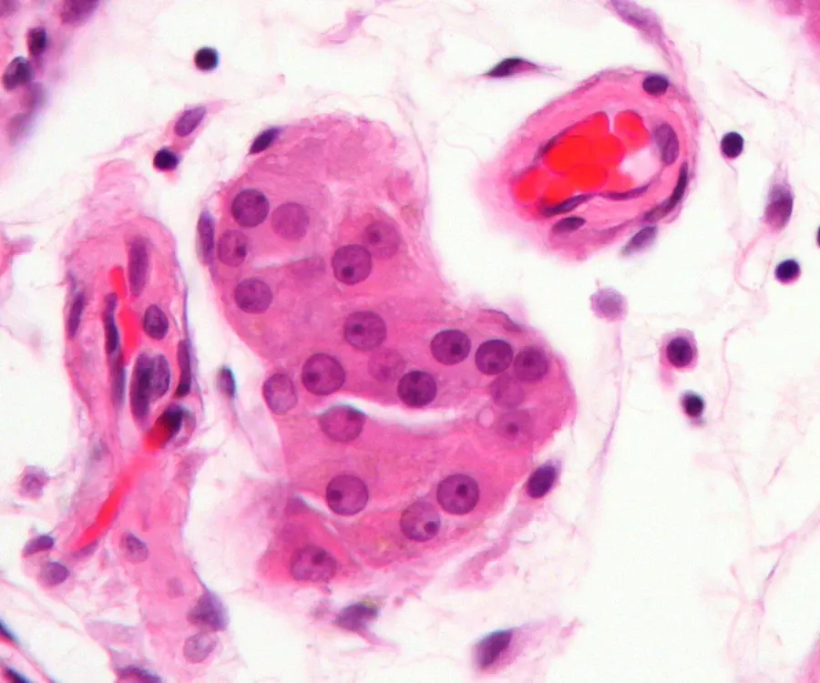 La carte Cellule de Leydig