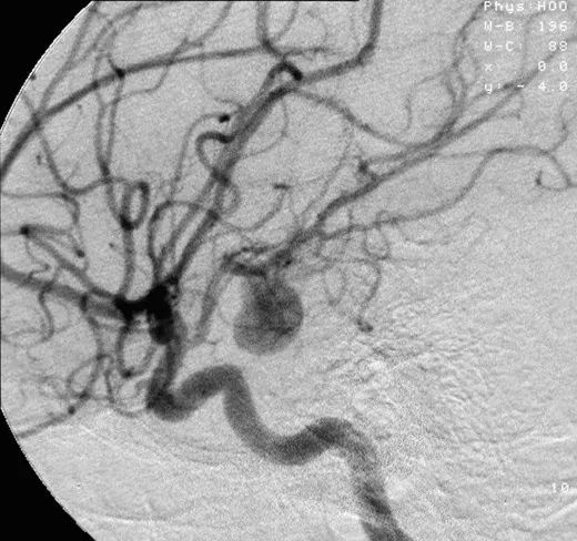 La carte Neuroradiologie