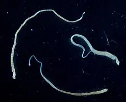 The Hymenolepis nana card