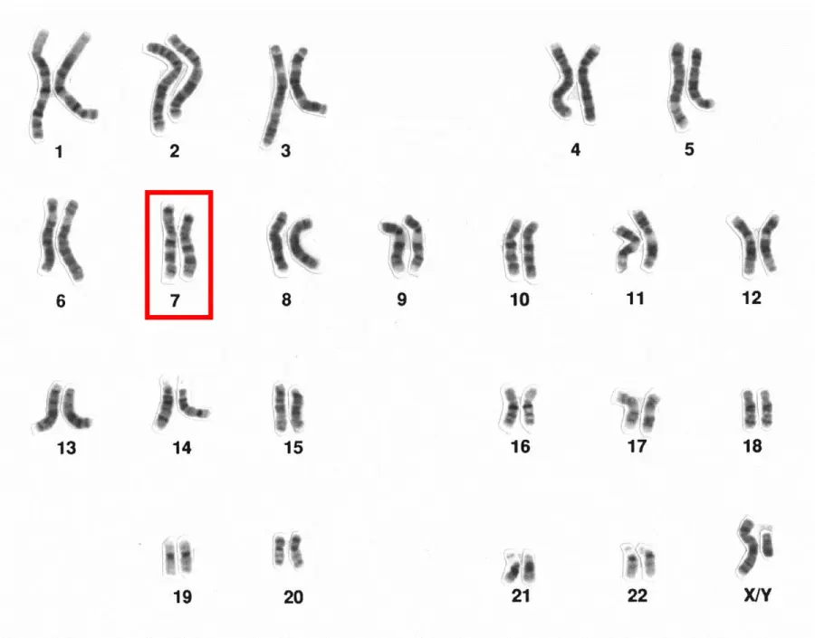 La carte Chromosome 7 humain