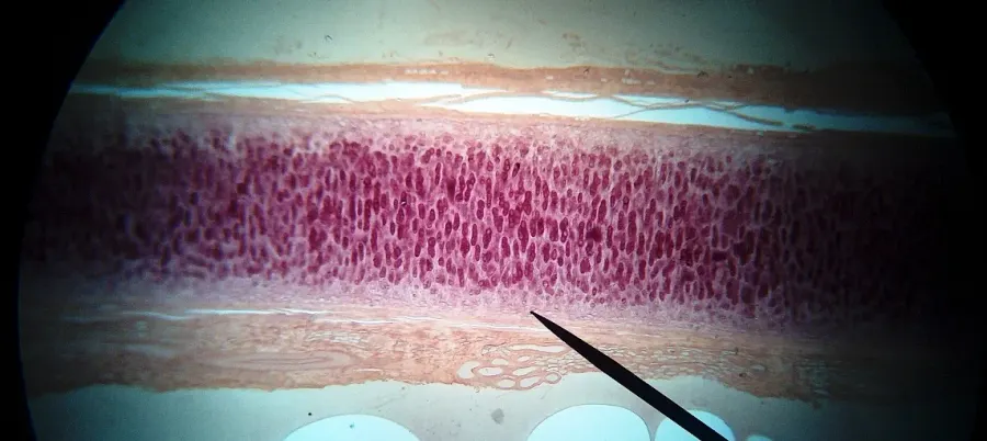 The Perichondrium card