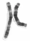 La carte Chromosome 3 humain