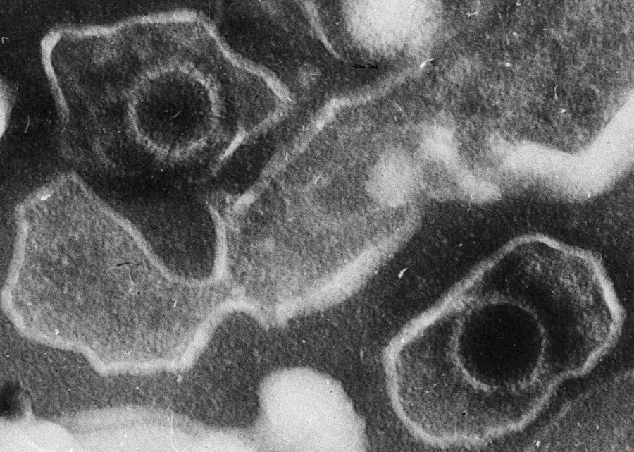 The Epstein–Barr virus card