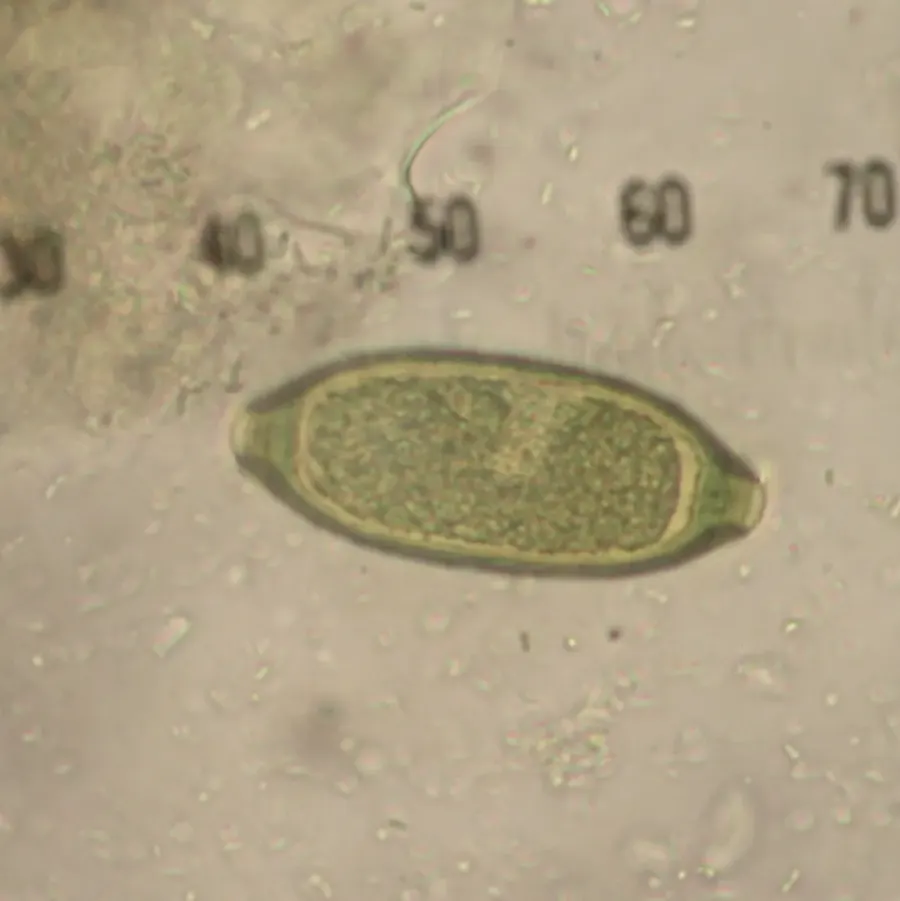 The Trichuris card