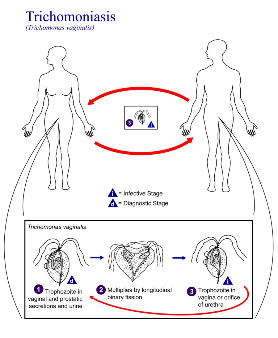The Trichomoniasis card