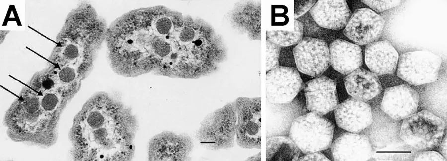 La carte Carboxysome