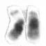 La carte Chromosome 21 humain