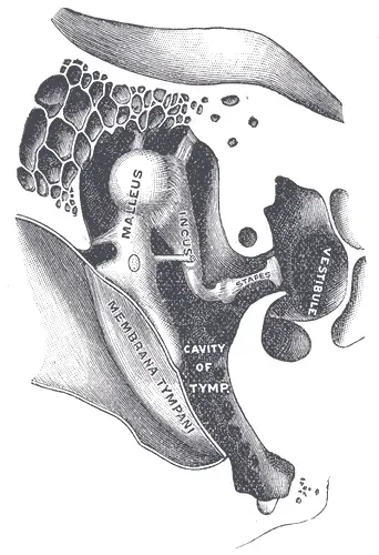 The Otosclerosis card