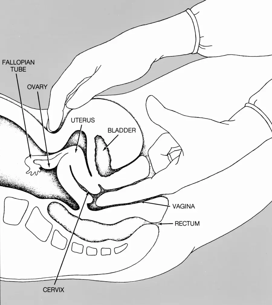 The Pelvic examination card