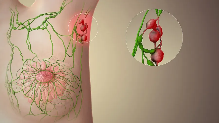 The Sentinel lymph node card