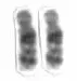 La carte Chromosome 18 humain
