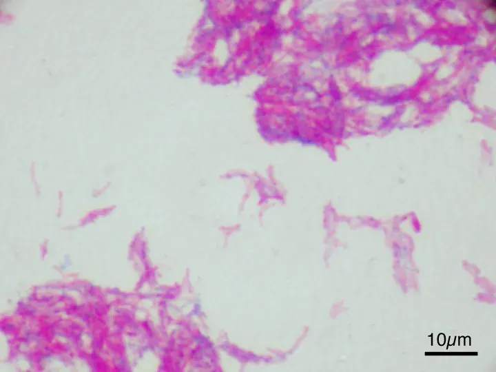 La carte Vaccin bilié de Calmette et Guérin