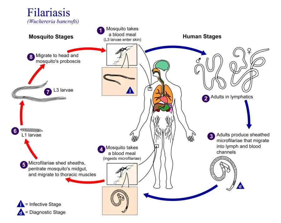 The Filariasis card