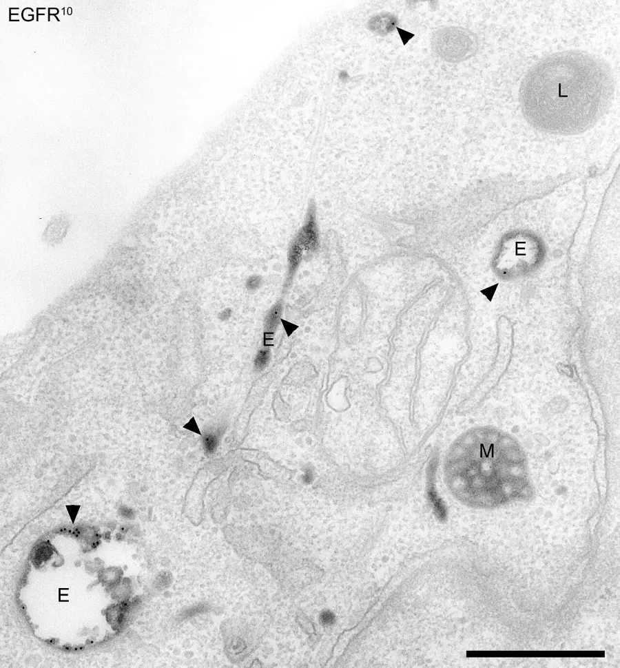 La carte Endosome