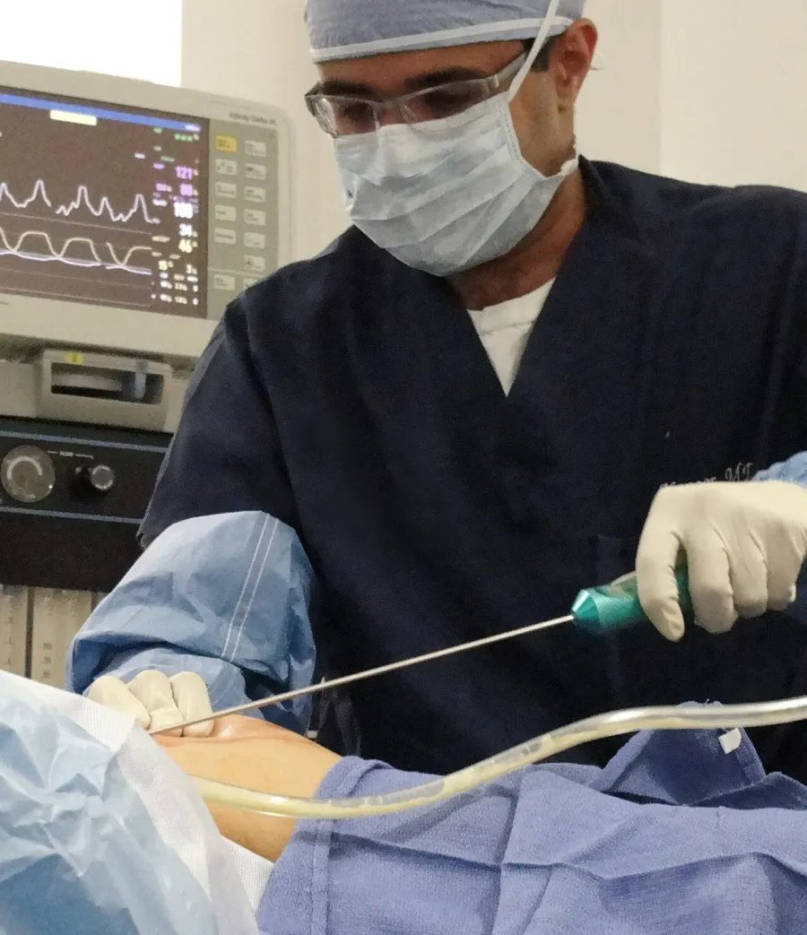 The Liposuction card