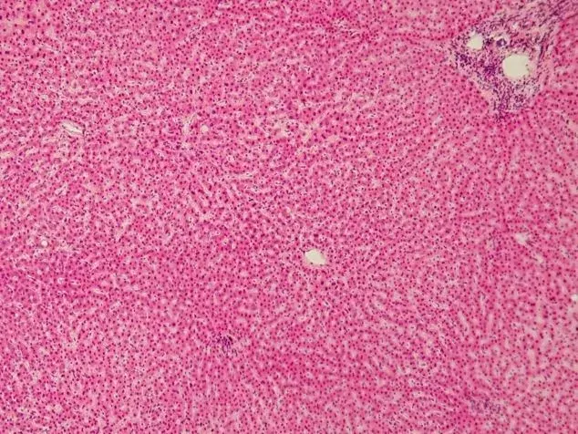 La carte Hépatocyte