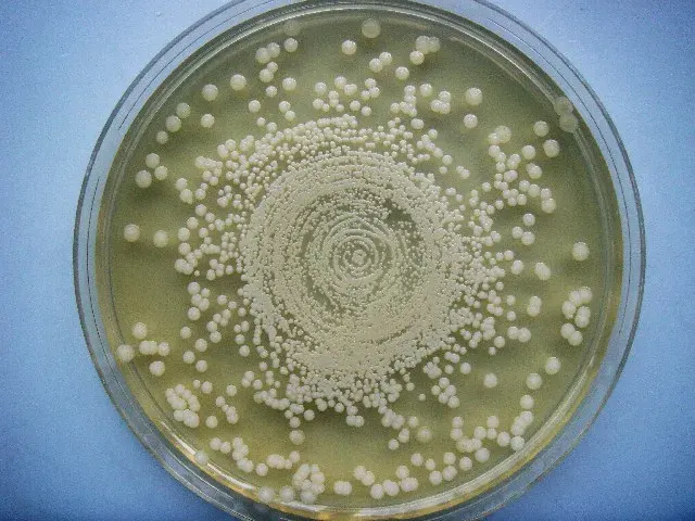 The Opportunistic infection card