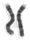 La carte Chromosome 4 humain
