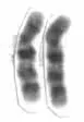 La carte Chromosome 10 humain