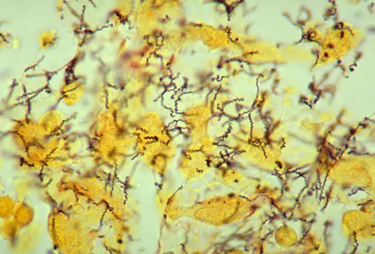 The Spirochaetaceae card