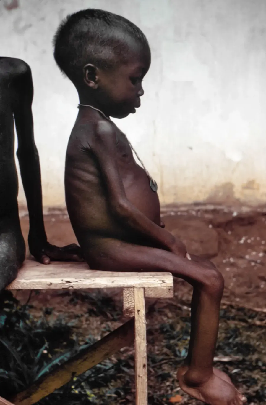 The Starvation card