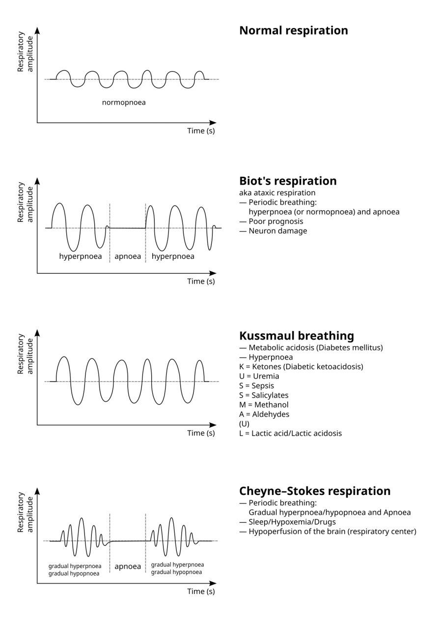 The Biot's respiration card