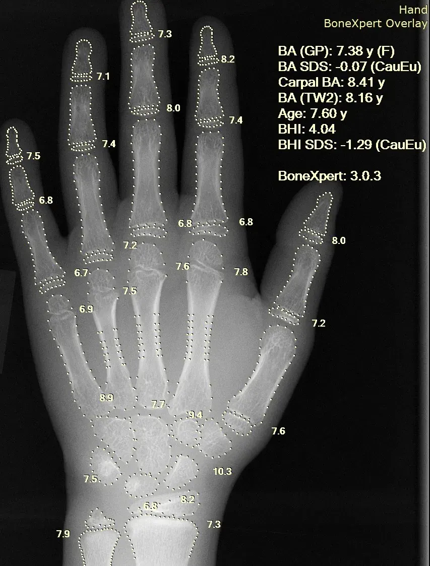 La carte Informatique médicale