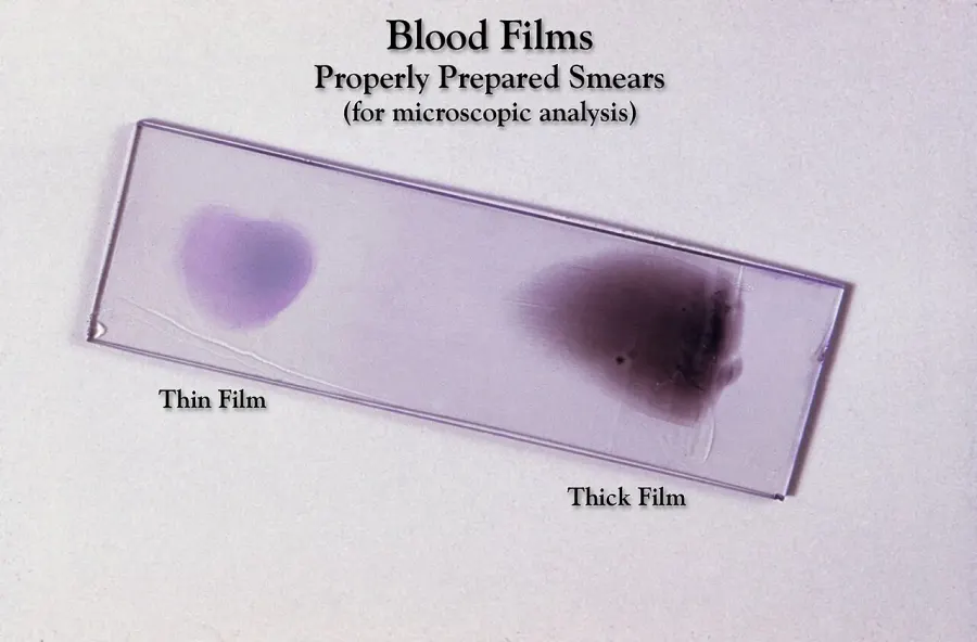 The Blood smear card