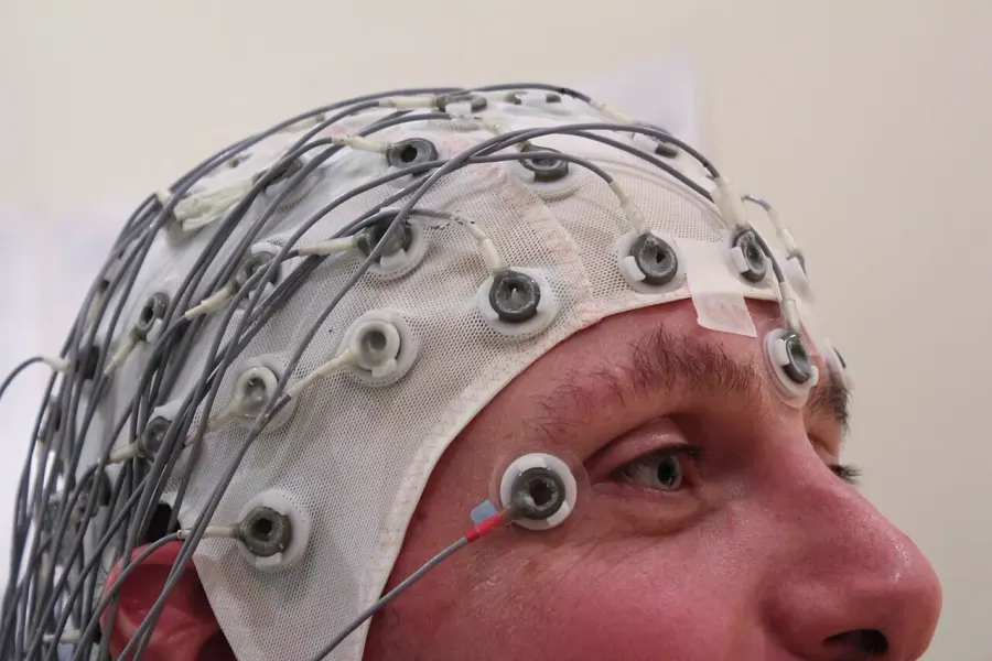 The Brain–computer interface card