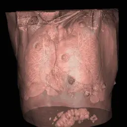 The Medical imaging card