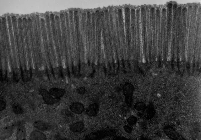 La carte Microvillosité